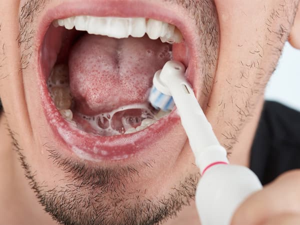 Connection between oral health and systemic diseases