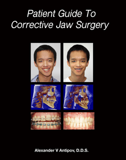 Orthognathic Surgery